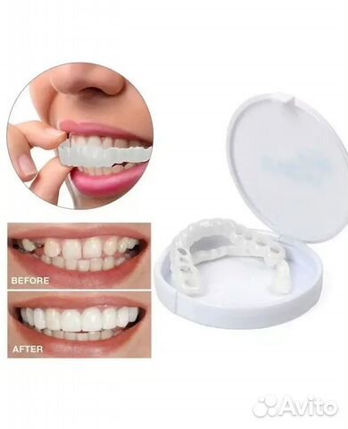 Виниры Snap-On Smile Виниры Snap-On Smile