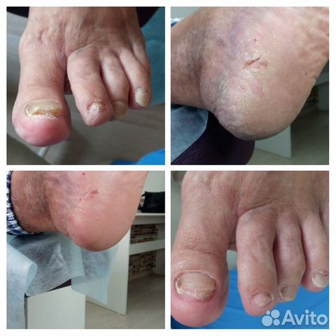 Подология и эстетический педикюр, маникюр, подолог